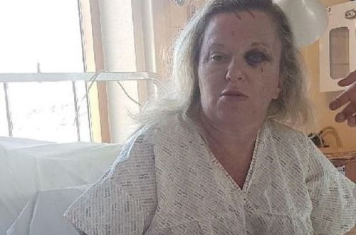 Qadınlar gözəl göründüklərinə görə döyüldülər - FOTO