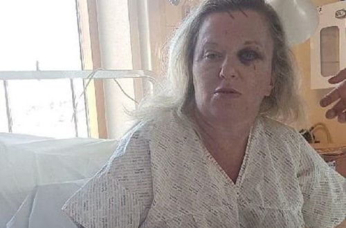 Всему виной - зависть: мать и дочь жестоко избили женщину - ФОТО