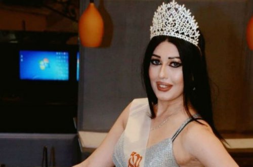 Azərbaycan gözəlindən YENİ PAYLAŞIM — Gözəlliyin göz qamaşdırır