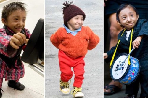 Dünyanın ən kiçik adamı vəfat edib — FOTO + VİDEO