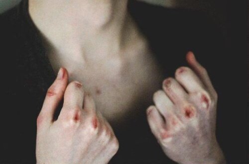 Bakıda qadın əri tərəfindən vəhşicəsinə döyüldü