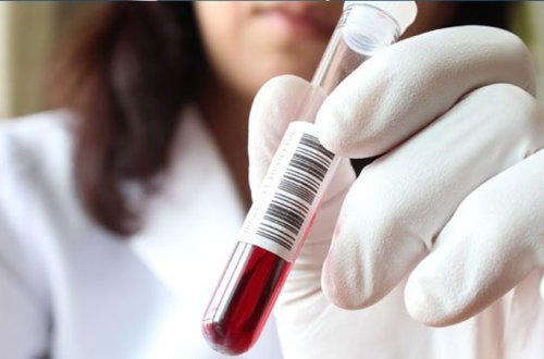 Azərbaycan yeni qorxulu virusun gəlişinə hazırdırmı? (PROFESSOR)