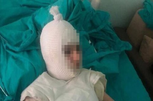 Ana tətilə gələn ögey qızının başına qaynar su tökdü - DƏHŞƏT