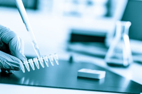 Koronavirus testləri Azərbaycanda kimlərə tətbiq olunacaq?