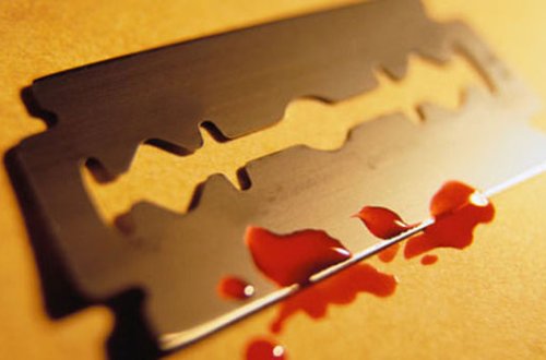 В Баку брат перерезал горло сестре