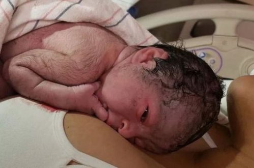 “Köynəkdə” doğulan uşaq hər kəsi heyrətə gətirdi - FOTO