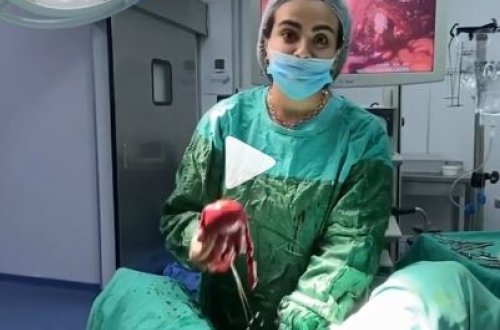 Bakıda həkim qadın üzərində aparılan əməliyyatın 18+ videosunu paylaşdı