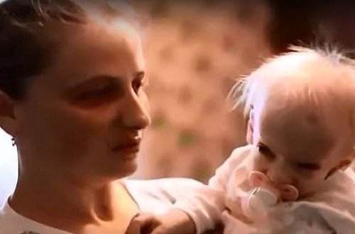 Səkkiz yaşlı uşaq qocalıqdan öldü - VİDEO