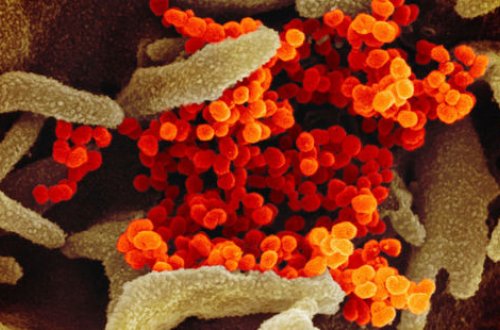 Çində koronavirusun qurbanlarının sayı 1868 nəfərə çatıb