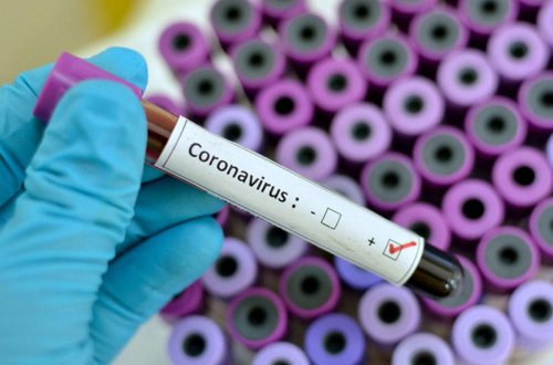 Azərbaycan alimi Türkiyədə koronavirusla bağlı tədqiqatlar aparır