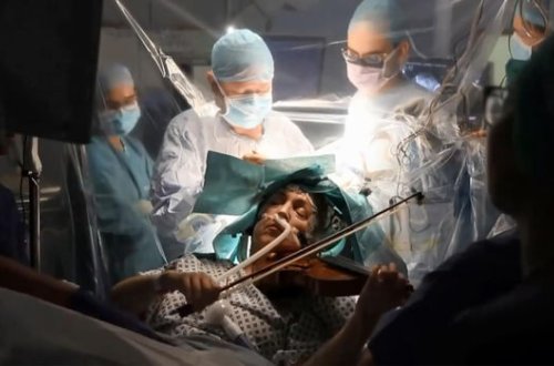 Xəstə beyin əməliyyatı zamanı skripka çaldı - VİDEO