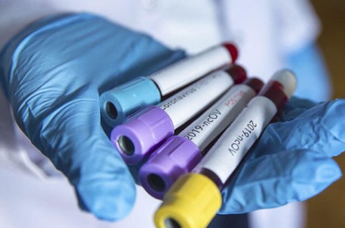 İranda iki nəfərdə koronavirus aşkarlandı