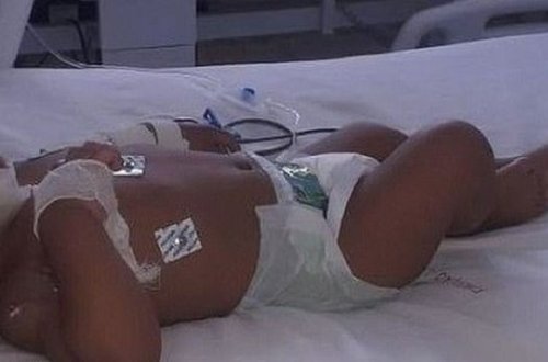 Telefonu uşağın yanında enerjiyə qoşan valideynin məsuliyyətsizliyinin acı nəticəsi - FOTO