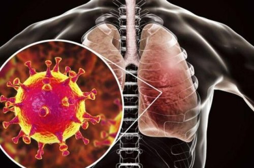 Koronavirus immuniteti zəif olanları məhv edir