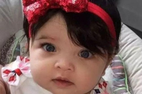 Dünya bu 11 aylıq qıza heyrandır - FOTO