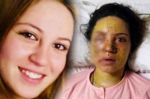 Boşanmaq istəyən 21 yaşlı həyat yoldaşını gözündən güllələdi - FOTO