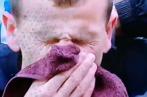 Футболист сломал себе нос, когда пытался пробить через себя - ВИДЕО