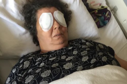 Xəstəxanada DƏHŞƏT: Qadının gözlərini əlləriylə çıxarıb yedi - FOTO