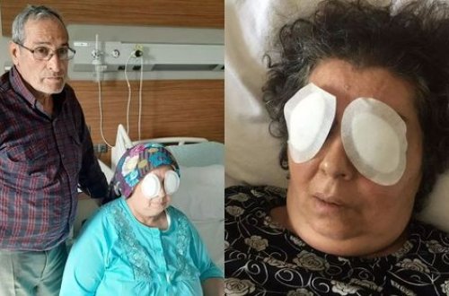 Qadının gözlərini çıxarıb yedi - VİDEO