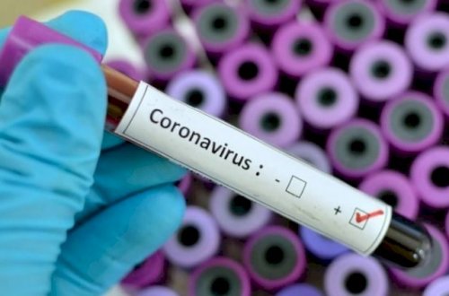 Koronavirusu bu üsulla müalicə etmək mümkündür - Təsdiqləndi