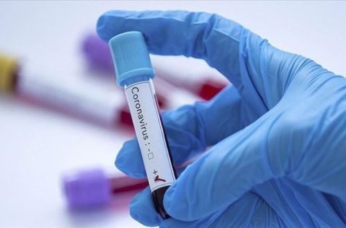 Число инфицированных коронавирусом в Армении достигло 30