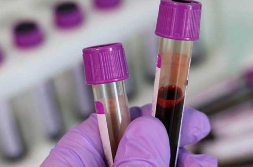 Koronavirusla bağlı son STATİSTİKA