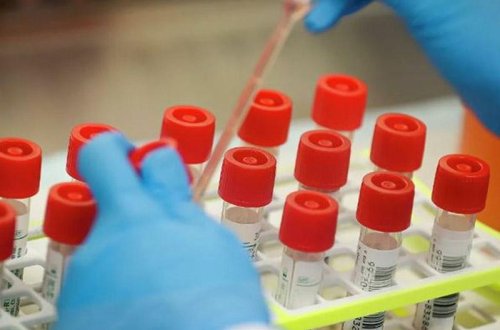 Sinqapurda 5 dəqiqəyə koronavirusu aşkar edən test hazırlanıb