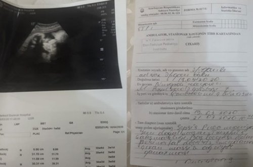 Bakıda qeysəriyyə əməliyyatından sonra körpə öldü - Foto