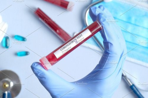 SON DƏQİQƏ: Azərbaycanda daha 43 nəfərdə koronavirus tapıldı - RƏSMİ
