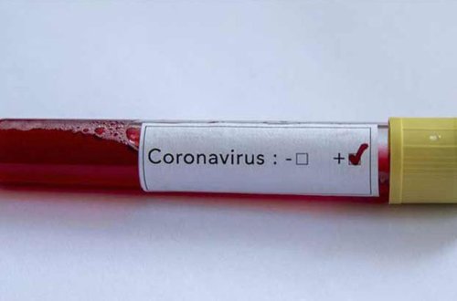 Dünyanı ümidləndirən açıqlama: 