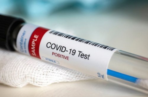 Azərbaycanda yüksək vəzifəli şəxsdə koronavirus aşkarlandı