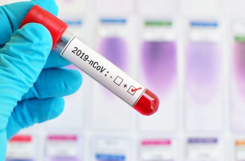 Azərbaycanda daha 27 nəfərdə koronavirus aşkarlandı