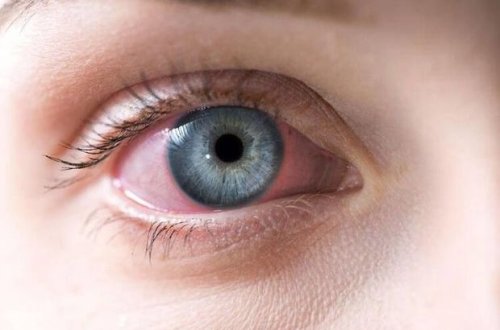 Koronavirusunun yeni simptomu aşkar olundu