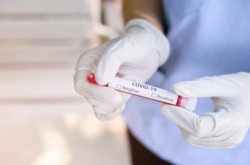 Ermənistanda şok yaradan xəbər: Virusu müəyyən edənlər özləri virusa yoluxdu - KÜTLƏVİ