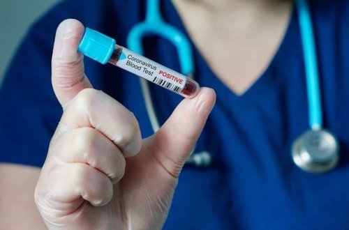 В Азербайджане выявлено 64 новых случая заражения коронавирусом - ОБНОВЛЕНО