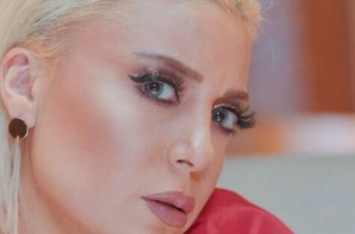 Səidə dodağını yenə şişirtdi - İZLƏYİCİLƏRİ TƏNQİD ETDİ - FOTO