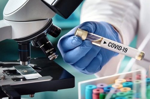 Koronavirus bu yolla da insanları yoluxdurur — Yaponiyalı həkim açıqladı