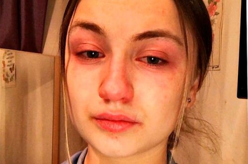 Tibb bacısı koronaviruslu xəstələrin əzabından danışdı