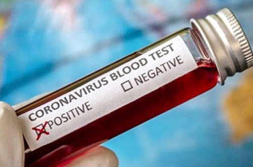 Türkiyə koronavirusun daha bir müalicə üsulunu tapdı — 15 dəqiqə ərzində...