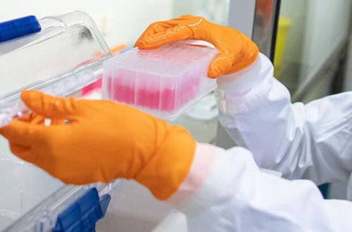 Türkiyə laboratoriyalarında koronavirus test nəticələri gizlədilib