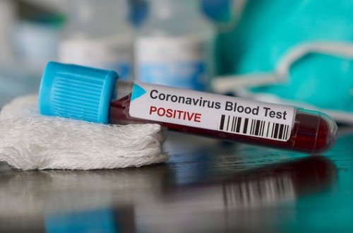 Azərbaycanda 43 yeni koronavirus (COVID-19) infeksiyasına yoluxma faktı qeydə alın - RƏSMİ