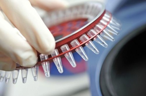 TƏBİB xəbərdarlıq edir: “Bir yoluxma halı 60-a yaxın insanı yoluxdurur”