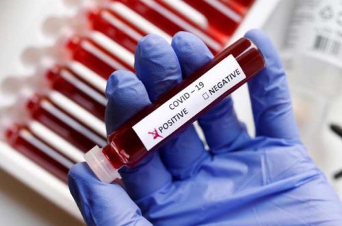 Çinin yardım üçün göndərdiyi testlərdə koronavirus aşkarlandı