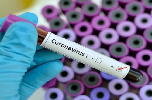 Naxçıvanda 18 nəfərdə koronavirus aşkarlandı