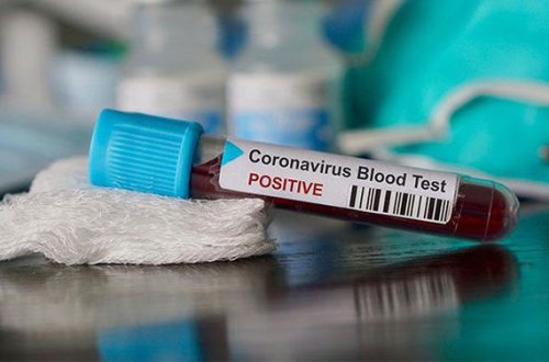 Azərbaycanda daha 12 nəfər koronavirusdan sağaldı - RƏSMİ