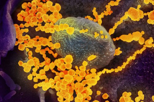 Genetik: Koronavirus özünü çox qeyri-adi aparır