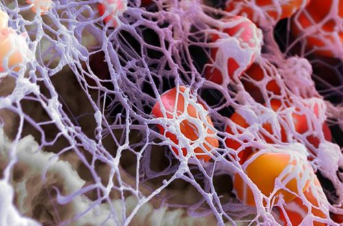 Alimlərlərdən koronavirus haqqında DAHA BİR YENİLİK — Bu yolla ölümün qarşısı alına bilər