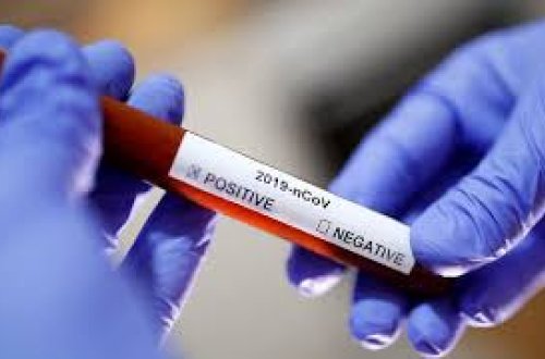 Azərbaycanda altı yaşlı uşaq koronavirusa yoluxdu - RƏSMİ