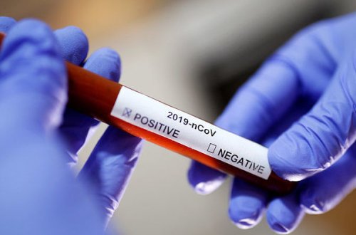 В Азербайджане шестилетний ребенок заразился коронавирусом - ОФИЦИАЛЬНО + ФОТО