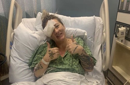 Парикмахер чуть не лишилась глаза из-за обычного обрезка волос – ФОТО